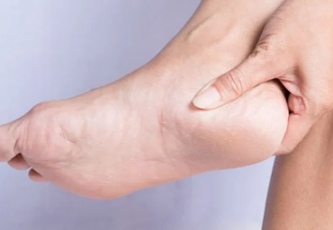 160922_foot-treatment-720x379.webp