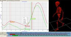 knee-pain-graph.jpg