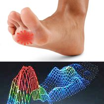 metatarsalgia-plantar-plate.jpg